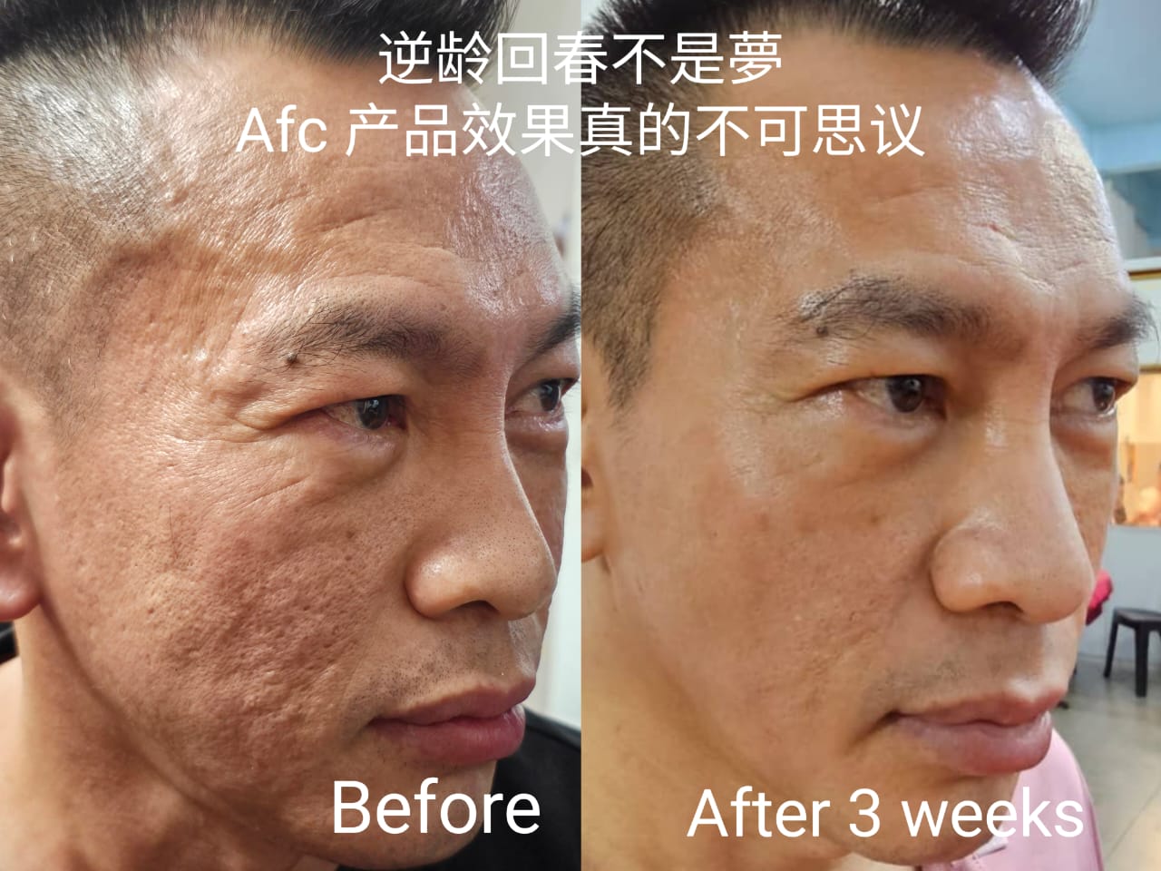 日常护理记录 图片